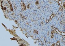 FIS1 Antibody - 1:100 staining mouse kidney tissue by IHC-P. The sample was formaldehyde fixed and a heat mediated antigen retrieval step in citrate buffer was performed. The sample was then blocked and incubated with the antibody for 1.5 hours at 22°C. An HRP conjugated goat anti-rabbit antibody was used as the secondary.