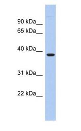 FITM1 Antibody - FITM1 antibody Western Blot of LOC161247 Antibody validated by WB using Fetal liver cell lysate at 0.2-1 ug/ml.  This image was taken for the unconjugated form of this product. Other forms have not been tested.
