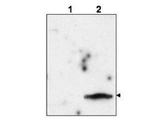 FIV p15 Antibody - Anti-FIV Matrix Protein p15 Antibody - Western Blot. Western blot of affinity purified anti-FIV Matrix Protein p15 to detect p15 in the culture supernatant of FIV-infected feline CrFK cells (lane 2, arrowhead). Lane 1 is an uninfected control. Virions were enriched by ultracentrifugation, lysed, resolved by electrophoresis, and transferred to nitrocellulose. The membrane was probed with the primary antibody at a 1:10000 dilution. Personal Communication, B. Luttge, CCR-NCI, Frederick, MD.