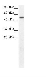 FIZ1 Antibody - Fetal Kidney Lysate.  This image was taken for the unconjugated form of this product. Other forms have not been tested.