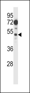 FIZ1 Antibody - FIZ1 Antibody western blot of 293 cell line lysates (35 ug/lane). The FIZ1 antibody detected the FIZ1 protein (arrow).