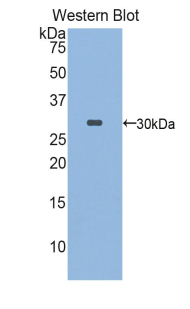 FKBP10 / FKBP65 Antibody - Western blot of recombinant FKBP10 / FKBP65.  This image was taken for the unconjugated form of this product. Other forms have not been tested.