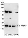 FKBP10 / FKBP65 Antibody - Detection of human and mouse FKBP10 by western blot. Samples: Whole cell lysate (50 µg) from HeLa, HEK293T, Jurkat, and mouse TCMK-1, cells prepared using NETN lysis buffer. Antibody: Affinity purified rabbit anti-FKBP10 antibody used for WB at 0.1 µg/ml. Detection: Chemiluminescence with an exposure time of 3 minutes.