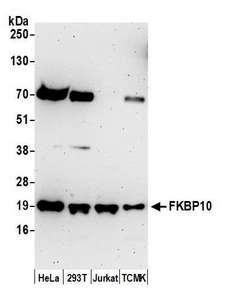 FKBP10 / FKBP65 Antibody - Detection of human and mouse FKBP10 by western blot. Samples: Whole cell lysate (50 µg) from HeLa, HEK293T, Jurkat, and mouse TCMK-1, cells prepared using NETN lysis buffer. Antibody: Affinity purified rabbit anti-FKBP10 antibody used for WB at 0.1 µg/ml. Detection: Chemiluminescence with an exposure time of 3 minutes.