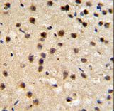 FKBP10 / FKBP65 Antibody - FKBP10 Antibody IHC of formalin-fixed and paraffin-embedded mouse brain tissue followed by peroxidase-conjugated secondary antibody and DAB staining.