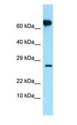 FKBP10 / FKBP65 Antibody - FKBP10 / FKBP65 antibody Western Blot of Placenta.  This image was taken for the unconjugated form of this product. Other forms have not been tested.