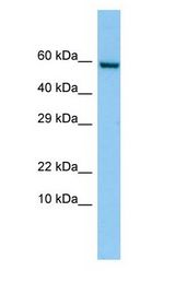 FKBP10 / FKBP65 Antibody - FKBP10 / FKBP65 antibody Western Blot of PANC1 cell lysate. FKBP10 is supported by BioGPS gene expression data to be expressed in PANC1.  This image was taken for the unconjugated form of this product. Other forms have not been tested.