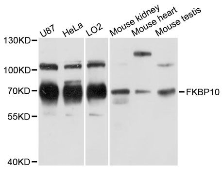 FKBP10 / FKBP65 Antibody - Western blot analysis of extracts of various cell lines, using FKBP10 antibody at 1:3000 dilution. The secondary antibody used was an HRP Goat Anti-Rabbit IgG (H+L) at 1:10000 dilution. Lysates were loaded 25ug per lane and 3% nonfat dry milk in TBST was used for blocking. An ECL Kit was used for detection and the exposure time was 30s.