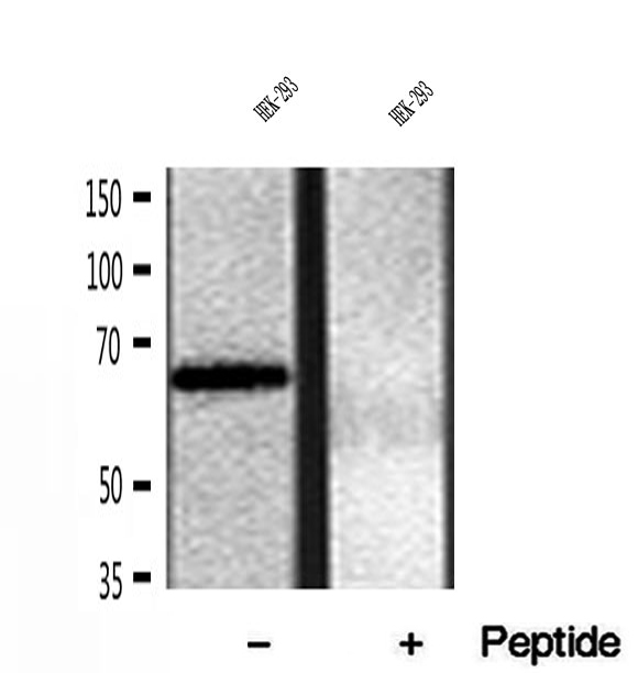 FKBP10 / FKBP65 Antibody - Western blot analysis of extracts of HEK293 cells using FKBP65 antibody.