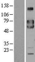 FKBP10 / FKBP65 Protein - Western validation with an anti-DDK antibody * L: Control HEK293 lysate R: Over-expression lysate