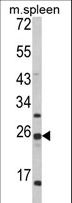 FKBP11 Antibody - Western blot of FKBP11 Antibody in mouse spleen tissue lysates (35 ug/lane). FKBP11 (arrow) was detected using the purified antibody.