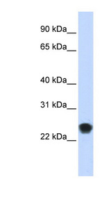 FKBP11 Antibody - FKBP11 antibody Western blot of Transfected 293T cell lysate. This image was taken for the unconjugated form of this product. Other forms have not been tested.