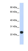 FKBP11 Antibody - FKBP11 antibody Western blot of Transfected 293T cell lysate. This image was taken for the unconjugated form of this product. Other forms have not been tested.