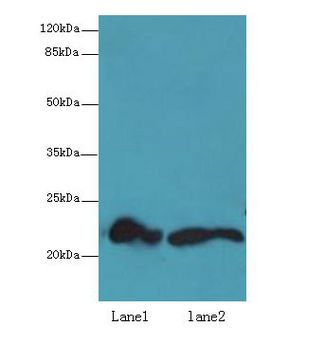 FKBP11 Antibody - Western blot. All lanes: FKBP11 antibody at 6 ug/ml. Lane 1: Mouse spleen tissue. Lane 2: Mouse liver tissue. Secondary Goat polyclonal to Rabbit IgG at 1:10000 dilution. Predicted band size: 22 kDa. Observed band size: 22 kDa.