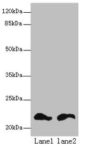 FKBP11 Antibody - Western blot All lanes: FKBP11 antibody at 6µg/ml Lane 1: Mouse spleen tissue Lane 2: Mouse liver tissue Secondary Goat polyclonal to rabbit IgG at 1/10000 dilution Predicted band size: 23, 16 kDa Observed band size: 23 kDa