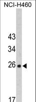FKBP14 Antibody - Western blot of FKBP14 Antibody in NCI-H460 cell line lysates (35 ug/lane). FKBP14 (arrow) was detected using the purified antibody.