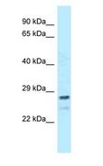 FKBP14 Antibody - FKBP14 antibody Western Blot of HeLa.  This image was taken for the unconjugated form of this product. Other forms have not been tested.