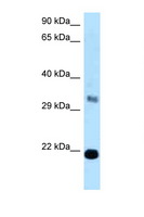 FKBP14 Antibody - FKBP14 antibody Western blot of Fetal Liver lysate. Antibody concentration 1 ug/ml.  This image was taken for the unconjugated form of this product. Other forms have not been tested.