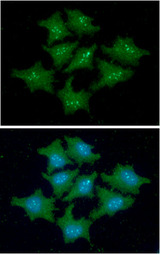 FKBP14 Antibody - ICC/IF analysis of FKBP14 in HeLa cells line, stained with DAPI (Blue) for nucleus staining and monoclonal anti-human FKBP14 antibody (1:100) with goat anti-mouse IgG-Alexa fluor 488 conjugate (Green).