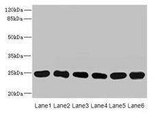 FKBP14 Antibody - Western blot All lanes: FKBP14 antibody at 1µg/ml Lane 1: Mouse stomach tissue Lane 2: Mouse gonadal tissue Lane 3: U937 whole cell lysate Lane 4: PC-3 whole cell lysate Lane 5: 293T whole cell lysate Lane 6: THP-1 whole cell lysate Secondary Goat polyclonal to rabbit IgG at 1/10000 dilution Predicted band size: 25 kDa Observed band size: 25 kDa