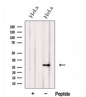FKBP14 Antibody - Western blot analysis of extracts of HeLa cells using FKBP14 antibody. The lane on the left was treated with blocking peptide.
