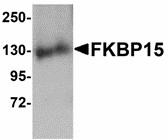 FKBP15 Antibody - Western blot of FKBP15 in 3T3 cell lysate with FKBP15 antibody at 1 ug/ml. Below: Immunohistochemistry of FKBP15 in mouse brain tissue with FKBP15 antibody at 2.5 ug/ml.