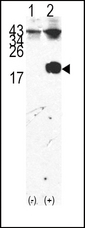 FKBP1A / FKBP12 Antibody - Western blot of FKBP12 (arrow) using rabbit polyclonal FKBP12 Antibody. 293 cell lysates (2 ug/lane) either nontransfected (Lane 1) or transiently transfected with the FKBP12 gene (Lane 2) (Origene Technologies).