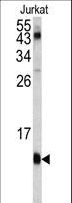 FKBP1A / FKBP12 Antibody - Western blot of FKBP1A antibody in Jurkat cell line lysates (35 ug/lane). FKBP1A (arrow) was detected using the purified antibody.