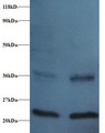 FKBP1A / FKBP12 Antibody - Western blot of Peptidyl-prolyl cis-trans isomerase FKBP1A antibody at 2 ug/ml. Lane 1: EC109 whole cell lysate. Lane 2: 293T whole cell lysate. Secondary: Goat polyclonal to Rabbit IgG at 1:15000 dilution. Predicted band size: 12 kDa. Observed band size: 22 kDa Additional bands at: 36 kDa. We are unsure as to the identity of these extra band.  This image was taken for the unconjugated form of this product. Other forms have not been tested.