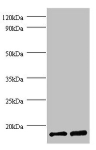 FKBP1A / FKBP12 Antibody - Western blot All lanes: Peptidyl-prolyl cis-trans isomerase FKBP1A antibody at 2µg/ml Lane 1: EC109 whole cell lysate Lane 2: 293T whole cell lysate Secondary Goat polyclonal to rabbit IgG at 1/15000 dilution Predicted band size: 12 kDa Observed band size: 12 kDa
