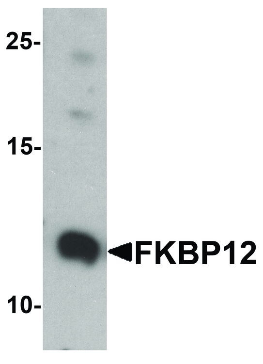 FKBP1A / FKBP12 Antibody - Western blot analysis of FKBP12 in A431 cell lysate with FKBP12 antibody at 1 ug/ml.