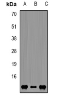 FKBP1A / FKBP12 Antibody - Western blot analysis of FKBP12 expression in Jurkat (A); SHSY5Y (B); mouse brain (C) whole cell lysates.