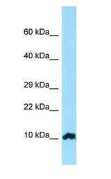 FKBP1A / FKBP12 Antibody - FKBP1A / FKBP12 antibody Western Blot of Placenta.  This image was taken for the unconjugated form of this product. Other forms have not been tested.