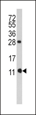 FKBP1B / FKBP12.6 Antibody - Western blot of anti-FKBP1B Antibody (N-term E6) in CEM cell line lysates (35 ug/lane). FKBP1B (arrow) was detected using the purified antibody.