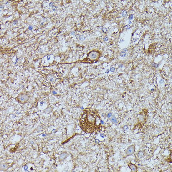 FKBP1B / FKBP12.6 Antibody - Immunohistochemistry of paraffin-embedded Mouse spinal cord using FKBP1B Polyclonal Antibody at dilution of 1:100 (40x lens).
