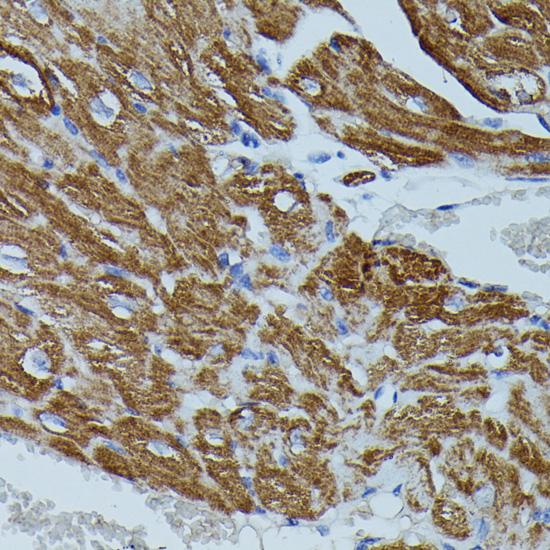 FKBP1B / FKBP12.6 Antibody - Immunohistochemistry of paraffin-embedded Mouse heart using FKBP1B Polyclonal Antibody at dilution of 1:100 (40x lens).