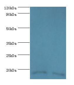 FKBP2 Antibody - Western blot. All lanes: Peptidyl-prolyl cis-trans isomerase FKBP2 antibody at 10 ug/ml. Lane 1: mouse thymus tissue. Lane 2: rat brain tissue. Secondary antibody: Goat polyclonal to rabbit at 1:10000 dilution. Predicted band size: 16 kDa. Observed band size: 16 kDa Immunohistochemistry.