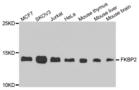 FKBP2 Antibody - Western blot analysis of extract of various cells.