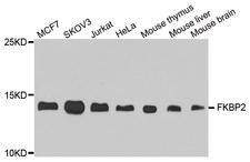FKBP2 Antibody - Western blot analysis of extract of various cells.