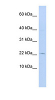 FKBP2 Antibody - FKBP2 antibody Western blot of 721_B cell lysate. This image was taken for the unconjugated form of this product. Other forms have not been tested.