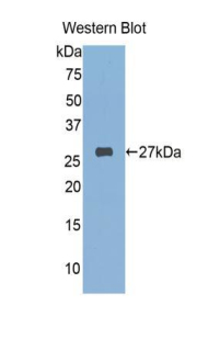 FKBP25 / FKBP3 Antibody - Western blot of recombinant FKBP25 / FKBP3.  This image was taken for the unconjugated form of this product. Other forms have not been tested.