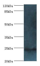 FKBP25 / FKBP3 Antibody - Western blot. All lanes: Peptidyl-prolyl cis-trans isomerase FKBP3 antibody at 2 ug/ml+mouse brain tissue. Secondary antibody: goat polyclonal to rabbit at 1:10000 dilution. Predicted band size: 25 kDa. Observed band size: 25 kDa.  This image was taken for the unconjugated form of this product. Other forms have not been tested.