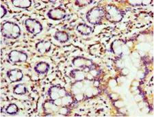 FKBP25 / FKBP3 Antibody - Immunohistochemistry of paraffin-embedded human small intestine using antibody at 1:100 dilution.  This image was taken for the unconjugated form of this product. Other forms have not been tested.