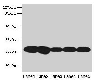 FKBP25 / FKBP3 Antibody - Western blot All lanes: Peptidyl-prolyl cis-trans isomerase FKBP3 antibody at 2µg/ml + Mouse brain tissue Secondary Goat polyclonal to rabbit IgG at 1/10000 dilution Predicted band size: 25 kDa Observed band size: 25 kDa