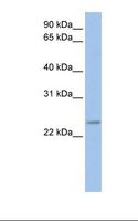 FKBP25 / FKBP3 Antibody - Jurkat cell lysate. Antibody concentration: 1.0 ug/ml. Gel concentration: 12%.  This image was taken for the unconjugated form of this product. Other forms have not been tested.