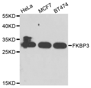 FKBP25 / FKBP3 Antibody - Western blot analysis of extracts of various cell lines.