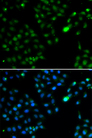 FKBP25 / FKBP3 Antibody - Immunofluorescence analysis of HeLa cells.