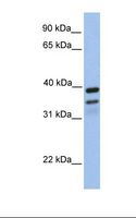 FKBP38 / FKBP8 Antibody - Fetal brain lysate. Antibody concentration: 1.0 ug/ml. Gel concentration: 12%.  This image was taken for the unconjugated form of this product. Other forms have not been tested.