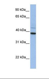 FKBP38 / FKBP8 Antibody - Hela cell lysate. Antibody concentration: 1.0 ug/ml. Gel concentration: 12%.  This image was taken for the unconjugated form of this product. Other forms have not been tested.