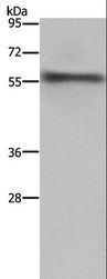 FKBP38 / FKBP8 Antibody - Western blot analysis of Mouse heart tissue, using FKBP8 Polyclonal Antibody at dilution of 1:1000.